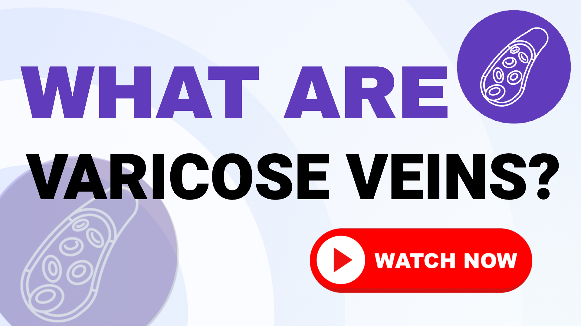 Varicose Veins Treatment